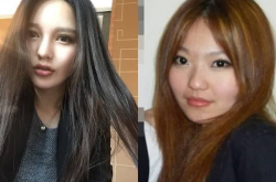 网红张景亦整容前后,揭秘网红蜕变之路